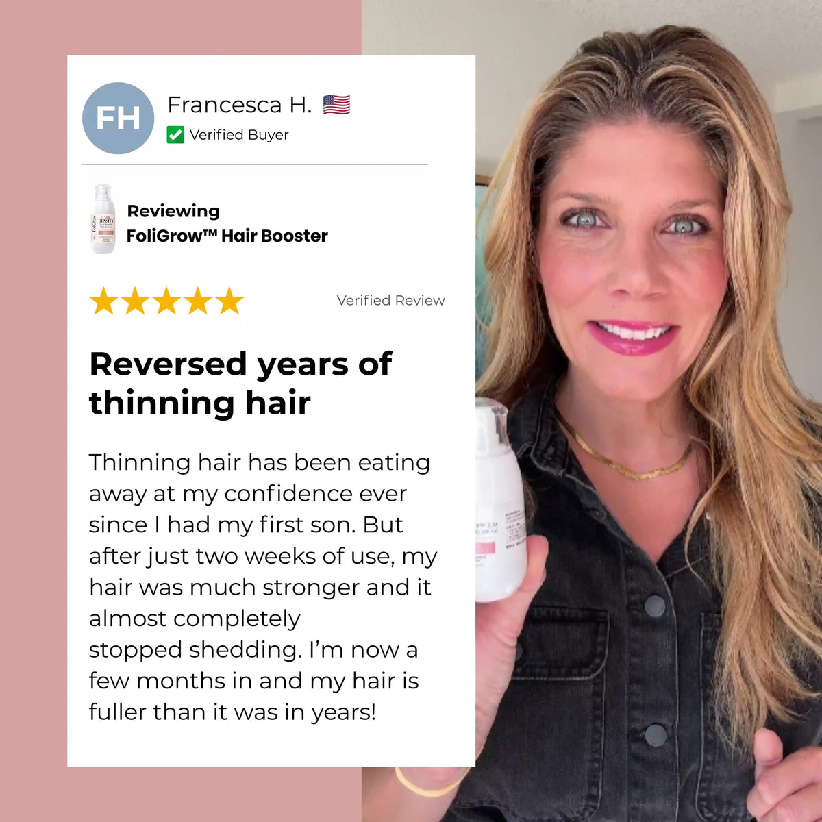 EXCLUSIVE DEAL 70% OFF🔥FoliGrow™ Advanced Dual-Peptide Hair Booster