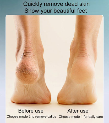 Electric Foot Callus Remover